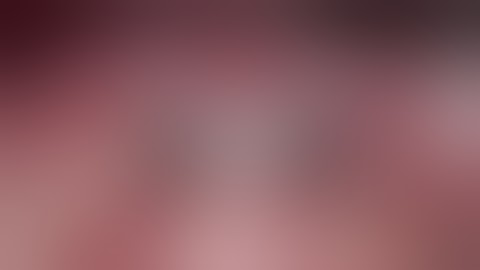 Easy2Fix Surgical Procedure By Prof. Jorge Jofre - 8 October