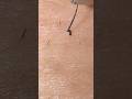 #hairremoval #blackheads #tweezers #毛抜き #extraction #satisfying