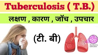 टी.बी -Tuberculosis Infection in hindi | T.B ke lakshan | T.B ka illaj  | T.B blood lab test