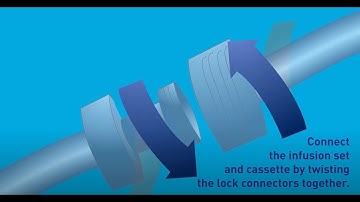 Remunity User Guide Video 3: Cassette Change