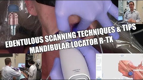 Mandibular Edentulous Intraoral Scanning Techniques with LOCATOR R-Tx