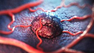 3D Scientific Animation: Oncology Drug Delivery MOA | AXS Studio