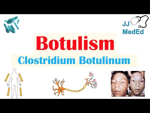 Botulism (Clostridium Botulinum) Pathogenesis, Symptoms, Diagnosis, Treatment, Prevention