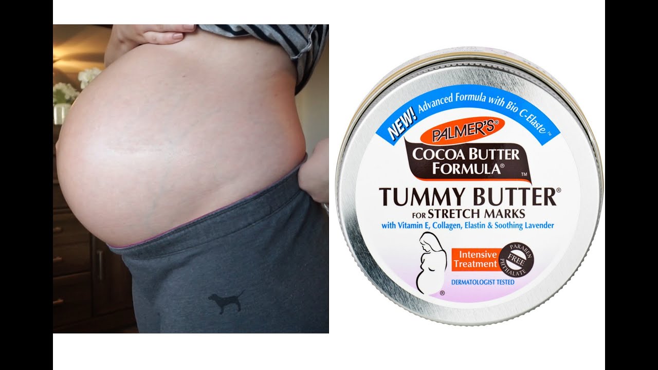 36 week pregnancy update| How to prevent stretch marks - YouTube