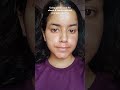 glycolic acid 8 months challenge #skincare #acne #pimple #glowwithglycolic #glycolicacid #acnemarks