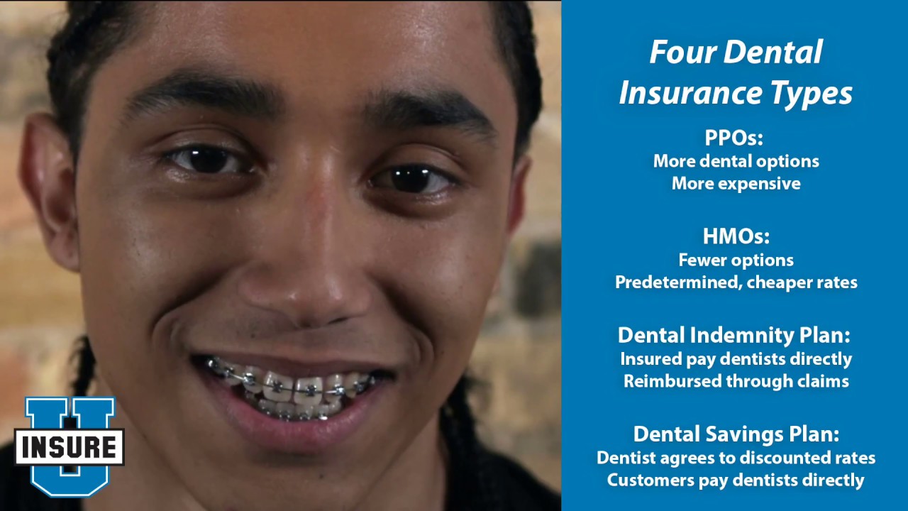 Does Insurance Cover Dental Braces?  