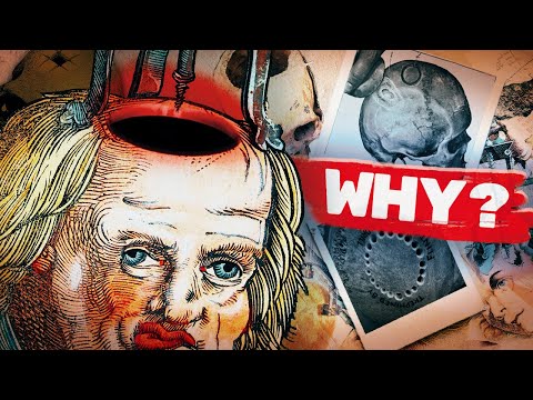 A history of trepanning: Why do we put holes in our skulls?