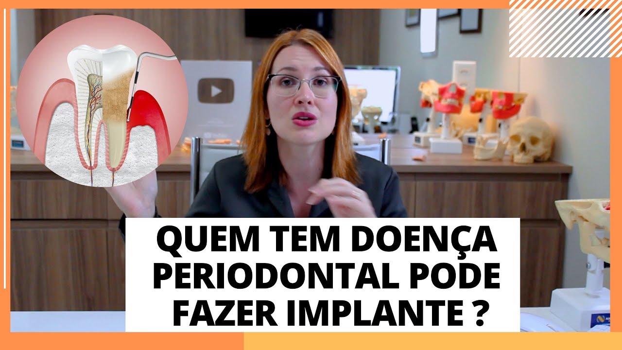 PACIENTE COM DOENÇA PERIODONTAL PODE FAZER IMPLANTE ? DRA. DANIELLE SALES