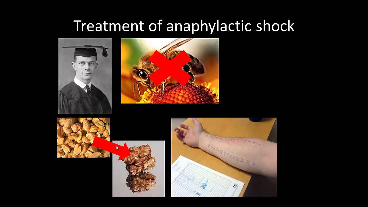 Treatment Of Anaphylactic Shock Youtube