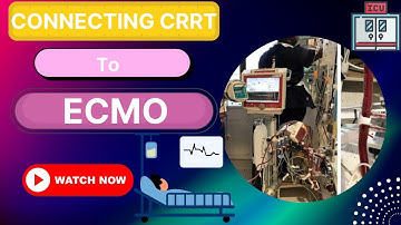 Connecting CRRT Machine  to an  ECMO Circuit