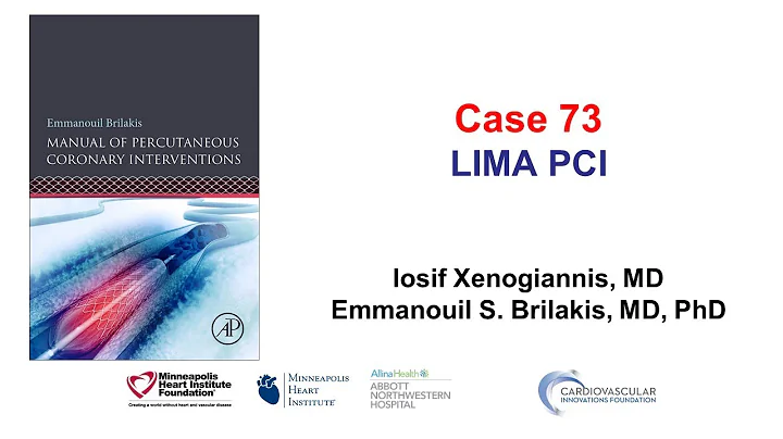 Case 73: PCI Manual: LIMA PCI