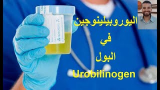 اليوروبيلينوجين في البول Urobilinogen in urine