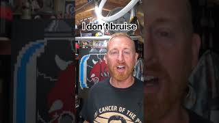 I don’t bruise…