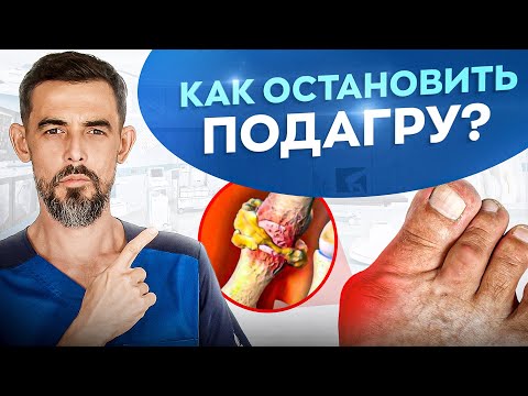 Подагра. Что делать? Моментально растворяет Кристаллы Мочевой Кислоты