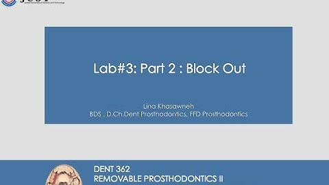 Lab 3 : Part 2 : Block Out Procedure for Provisional Removable Partial Denture