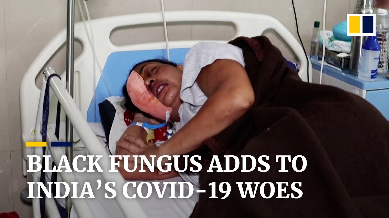 The Black Fungus Nightmare Facing India S Coronavirus Patients Youtube