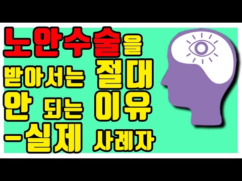 노안 수술을 쉽게 받아서는 절대 안 되는 이유 -실제 사례자 -아이구루 59