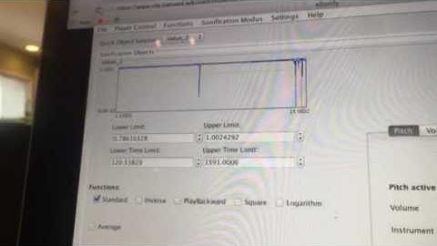 Sonification of KIC 8462852