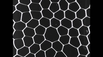 2D foam: the best way to understand liquid foam