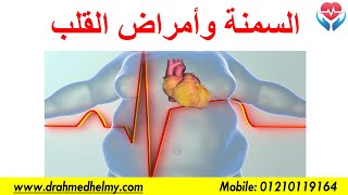 السمنة وأمراض القلب والأوعية الدموية