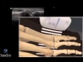 3D-пособие:  суставаультразвуковое исследование плюснефалангового стопы — SonoSite
