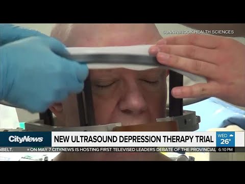 Clinical trial at Sunnybrook using ultrasound therapy to treat depression
