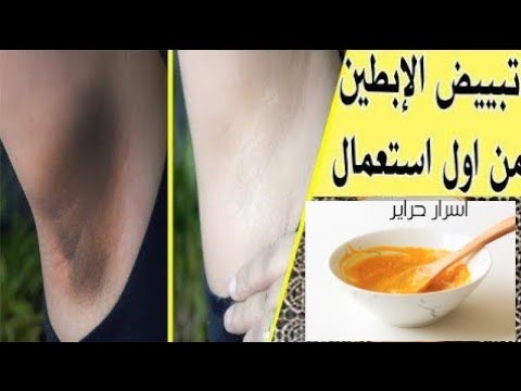 خلطة تبييض الابط