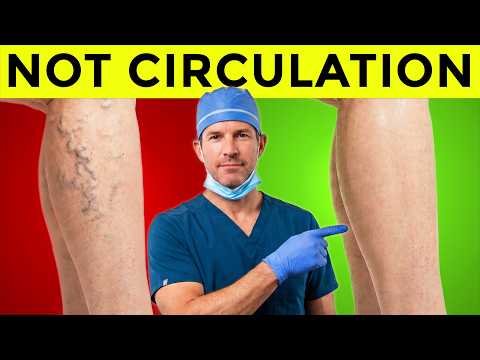 Varicose Veins Are NOT a Circulation Problem — This Is Why They Appear