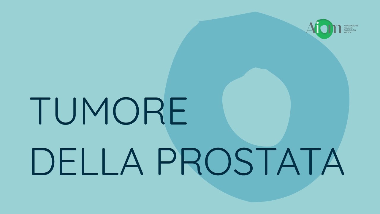 Webinar | Tumori ereditari maschili: Focus carcinoma della prostata