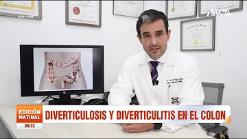 ¿Cómo diferenciar la diverticulitis de la diverticulosis?