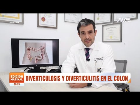 Video: ¿Cuál es la diferencia entre diverticulitis y diverticulosis?