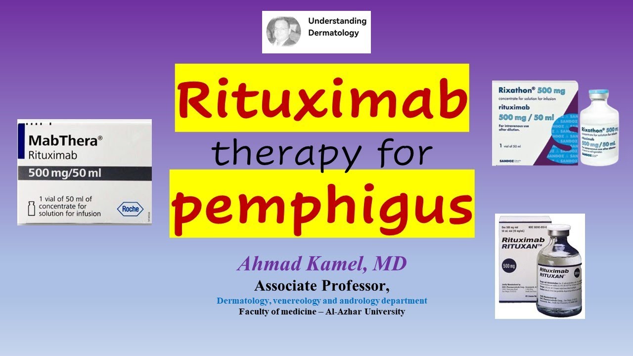 Rituximab therapy for Pemphigus