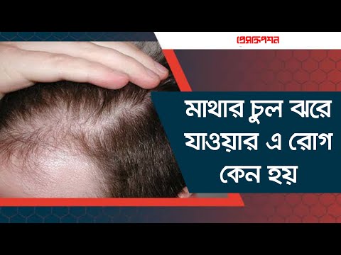 ভিডিও: মরা চুল কি লেগে থাকে?