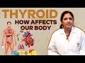 How Thyroid Affects Our Body - Effects of Hypothyroidism - Dr. Vennela Devarakonda|Renova Hospitals