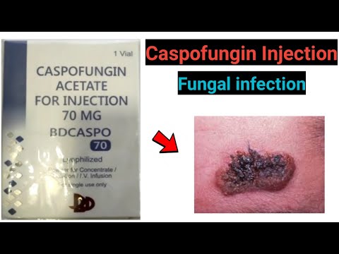 Caspofungin injection 50mg & 70mg - caspofungin acetate for injection in hindi