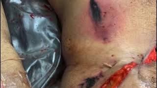 AUTOPSY (also known as Postmortem medical examination ) — IS the BODY OF EVIDENCE!!