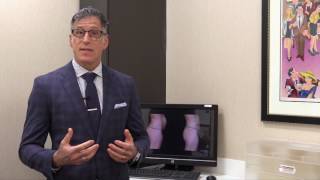 Dr. Cohen Describes a Tummy Tuck Patient Case