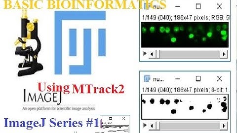 ImageJ - Using MTrack2 Plugin (ImageJ Series #1)