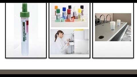 Multiplate  test process