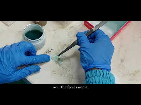 Video: Ascaris Lumbricoides Infekcijas Intensitātes Mērījumu Mainīguma Avoti Ar Kato-Katz Un QPCR