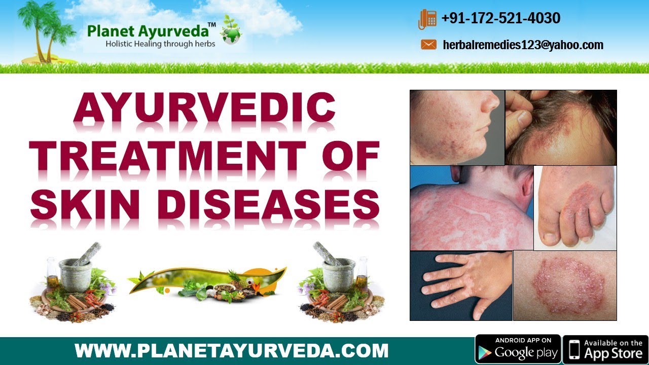 Ayurvedic Treatment of Skin Diseases - Types, Causes ...