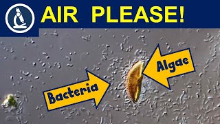 Why are there so many bacteria around the algae? 🔬 Making oxygen production visible