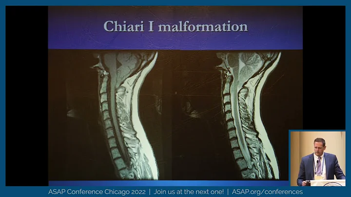 2022 Conference Dr Grant "Chiari I myths"