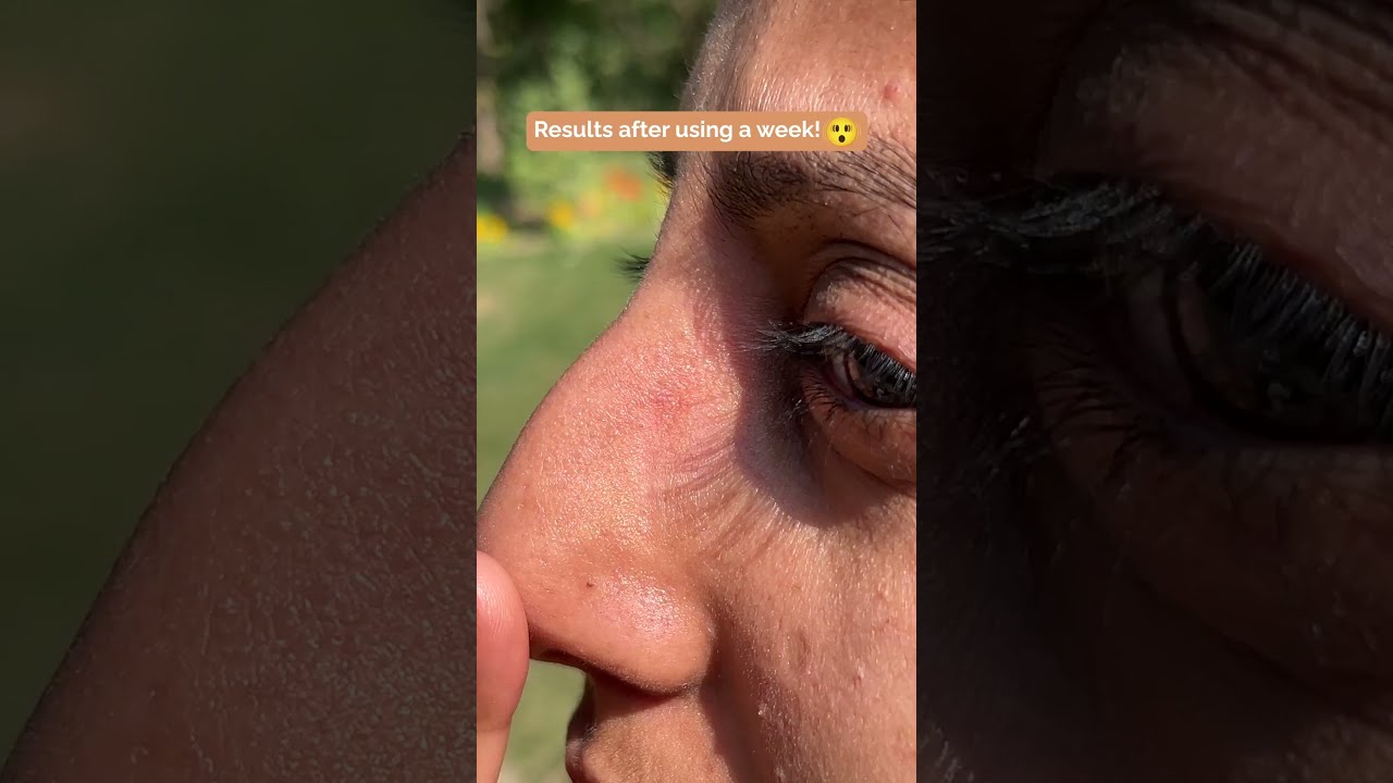 Best Daily Deep Pore Cleanser for Clear, Smooth Skin | Daily Use for Men & Women