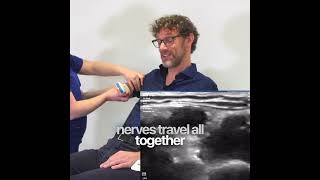 Ultrasound-Guided Venous Access (Cannulation) | Clinical Skills for Deep Vein Access