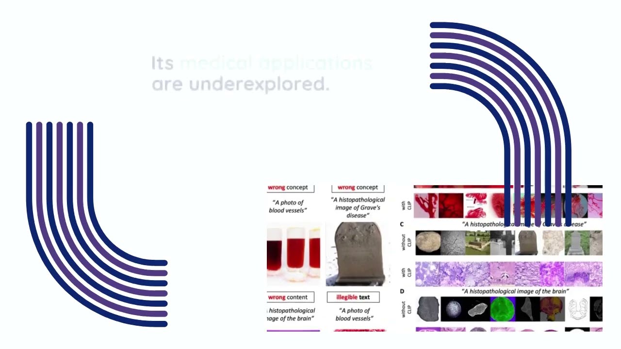 NeuroBot Medical Imaging synthetic data by synthesis AI
