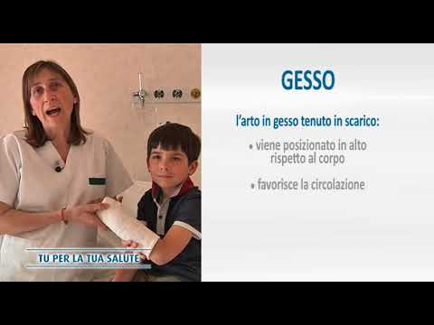 Video: Come gestire un braccio rotto (con immagini)