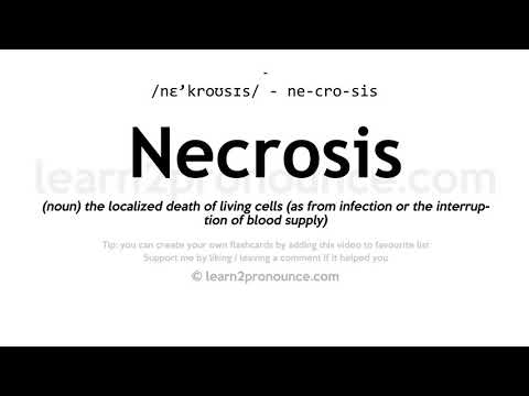 Necrosis መካከል አጠራር | Necrosis ትርጉም