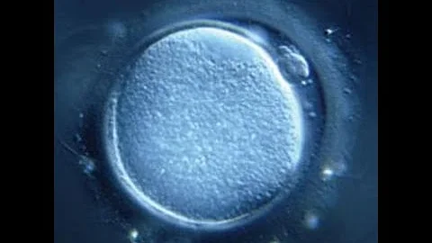 How stem cells are extracted from cloned human skin cells