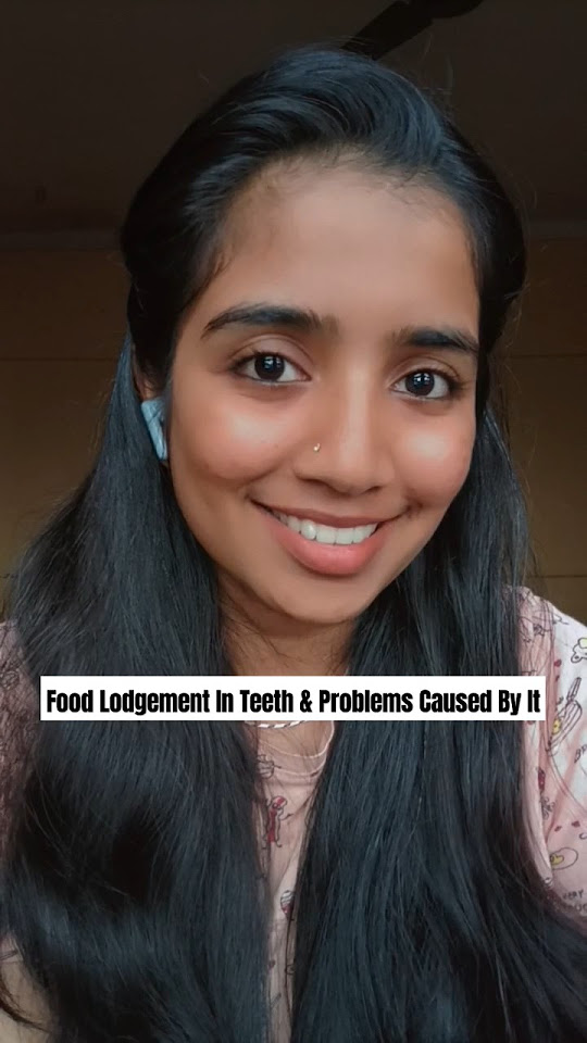 Food lodgement in the teeth problems caused by it youtube